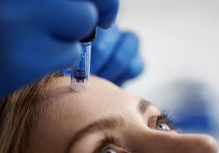 Opción #7: Dermapen microneedling
